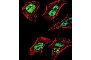 Immunofluorescence (IF) image for anti-Histone Deacetylase 2 (HDAC2) (AA 456-488), (C-Term) antibody (ABIN6242378)