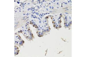 Immunohistochemistry of paraffin-embedded rat bronchus using DEPDC6 antibody (ABIN7266738) at dilution of 1:200 (40x lens).