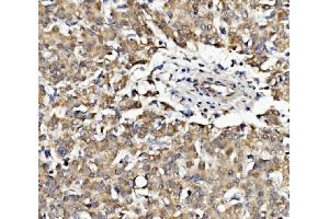 IHC analysis of EPB41L5 using anti-EPB41L5 antibody (ABIN7601550).