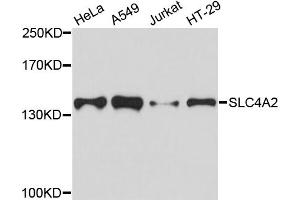 Western blot analysis of extracts of various cell lines, using SLC4A2 antibody. (SLC4A2 Antikörper)