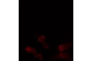 ABIN6276354 staining  Hela cells by IF/ICC. (ABL1 Antikörper  (N-Term))