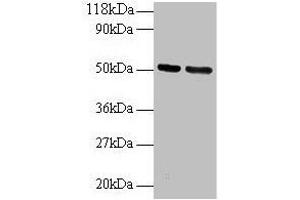 Western blot All lanes: GDI2 antibody at 2 μg/mL Lane 1: 293T whole cell lysate Lane 2: EC109 whole cell lysate Secondary Goat polyclonal to rabbit IgG at 1/15000 dilution Predicted band size: 51, 46 kDa Observed band size: 51 kDa (GDI2 Antikörper  (AA 1-441))
