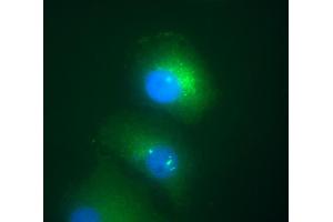 Immunofluorescence staining of Daxx in transfected HeLa human cervix carcinoma cell line.