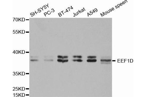 EEF1D Antikörper  (AA 1-160)