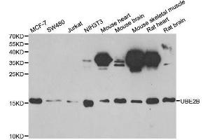 Western blot analysis of extracts of various cell lines, using UBE2B antibody.