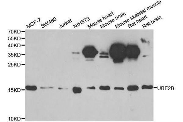 UBE2B Antikörper  (AA 1-152)
