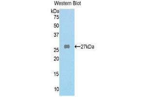 Western Blotting (WB) image for anti-Fumarylacetoacetate Hydrolase (Fumarylacetoacetase) (FAH) (AA 189-419) antibody (ABIN1858790) (FAH Antikörper  (AA 189-419))