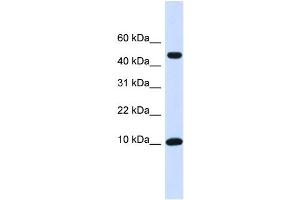 WB Suggested Anti-ZNF706 Antibody Titration:  0. (ZNF706 Antikörper  (N-Term))