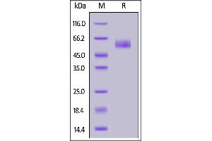 SDS-PAGE (SDS) image for Triggering Receptor Expressed On Myeloid Cells 2 (TREM2) (AA 19-171) (Active) protein (Fc Tag) (ABIN7013654)