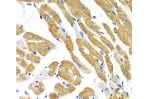Immunohistochemistry of paraffin-embedded Mouse heart using AIMP1 Polyclonal Antibody at dilution of 1:100 (40x lens). (AIMP1 Antikörper)