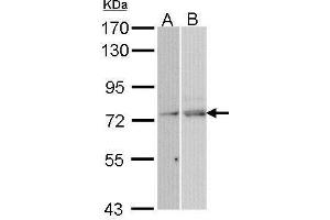 Western blot analysis of 30 ug of whole cell lysate (A: Hela; B: Molt-4) using a 7. (NXF1 Antikörper)
