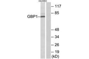 Western blot analysis of extracts from HuvEc cells, using GBP1 Antibody. (GBP1 Antikörper  (AA 71-120))