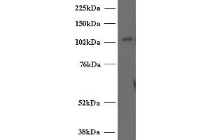 ABIN2563976 (2µg/ml) staining of Human T-lymphocyte lysate (35µg protein in RIPA buffer). (UNC13D Antikörper  (Internal Region))