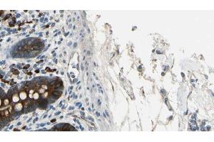 ABIN6267367 at 1/100 staining Mouse intestine tissue by IHC-P. (BCR Antikörper  (pTyr360))