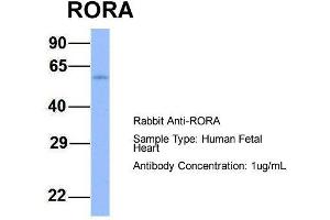 Host:  Rabbit  Target Name:  RORA  Sample Type:  Human Fetal Heart  Antibody Dilution:  1. (RORA Antikörper  (N-Term))