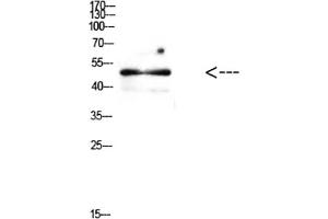 Western Blot analysis of mouse brain cells using Antibody diluted at 1:500. (E2F1 Antikörper  (AA 100-170))
