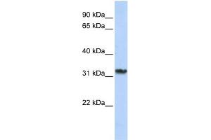 WB Suggested Anti-SMNDC1 Antibody Titration:  0.