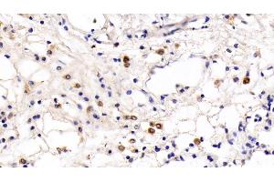 Immunohistochemistry (IHC) image for anti-Toll-Like Receptor 5 (TLR5) (AA 693-858) antibody (ABIN7426892)