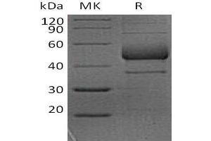 Western Blotting (WB) image for Inducible T-Cell Co-Stimulator (ICOS) protein (Fc Tag) (ABIN7321000) (ICOS Protein (Fc Tag))