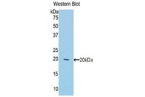 Western blot analysis of the recombinant protein. (Keratin 2 Antikörper  (AA 368-507))