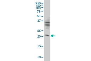 KIF26A monoclonal antibody (M01), clone 3C10 Western Blot analysis of KIF26A expression in HeLa . (KIF26A Antikörper  (AA 1-203))
