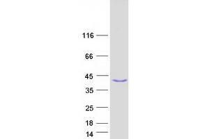 Western Blotting (WB) image for Acyl-CoA Binding Domain Containing 4 (ACBD4) (Transcript Variant 4) protein (Myc-DYKDDDDK Tag) (ABIN2714310)