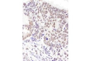 Immunohistochemistry (IHC) image for anti-serine/arginine-Rich Splicing Factor 6 (SRSF6) (AA 250-300) antibody (ABIN7454941) (SFRS6 Antikörper  (AA 250-300))