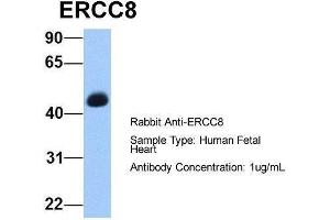 Host:  Rabbit  Target Name:  ERCC8  Sample Type:  Human Fetal Heart  Antibody Dilution:  1. (ERCC8 Antikörper  (C-Term))