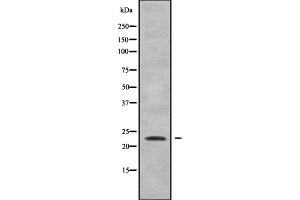 Western blot analysis of Rho G using Jurkat whole cell lysates