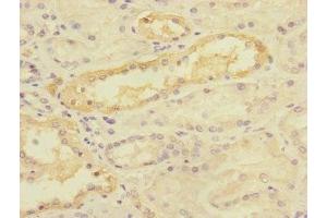 Immunohistochemistry of paraffin-embedded human kidney tissue using ABIN7159906 at dilution of 1:100 (TIMM5 (AA 87-353) Antikörper)