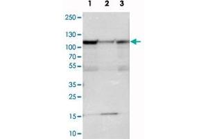 Western blot analysis of cell lysates with SMEK1 polyclonal antibody . (SMEK1 Antikörper)