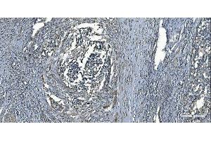 IHC analysis of MCU using anti-MCU antibody (ABIN7601931).