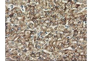 Immunohistochemical staining of paraffin-embedded Human liver tissue using anti-BECN1 mouse monoclonal antibody. (Beclin 1 Antikörper)