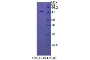 SDS-PAGE (SDS) image for CD46 (CD46) (AA 136-341) protein (His tag,GST tag) (ABIN1879385) (CD46 Protein (CD46) (AA 136-341) (His tag,GST tag))
