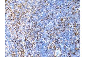 Immunohistochemistry of paraffin-embedded mouse liver using β-actin antibody. (beta Actin Antikörper)