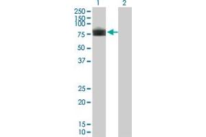 Western Blot analysis of PLXDC1 expression in transfected 293T cell line by PLXDC1 monoclonal antibody (M01), clone 4B10. (PLXDC1 Antikörper  (AA 313-421))
