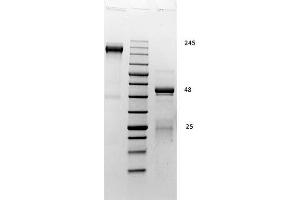 SDS PAGE of Rabbit Gamma Globulin. (gamma Globulin Fraction Protein)