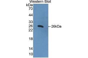 Western Blotting (WB) image for anti-Apolipoprotein B (APOB) antibody (FITC) (ABIN1862186) (APOB Antikörper  (FITC))