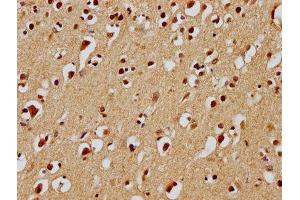 IHC image of ABIN7139932 diluted at 1:100 and staining in paraffin-embedded human brain tissue performed on a Leica BondTM system. (UBE2M Antikörper  (AA 11-28))