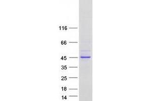Validation with Western Blot (MBNL3 Protein (Transcript Variant G) (Myc-DYKDDDDK Tag))