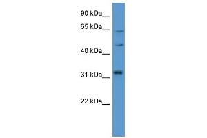 Western Blot showing MKNK1 antibody used at a concentration of 1-2 ug/ml to detect its target protein. (MKNK1 Antikörper  (C-Term))