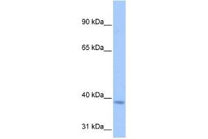 NSUN3 antibody used at 0. (NSUN3 Antikörper  (C-Term))