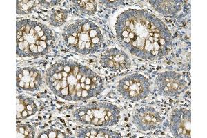 IHC analysis of ME2 using anti-ME2 antibody (ABIN7600967). (NAD-ME Antikörper  (AA 26-584))