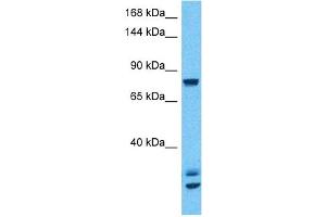 Host:  Rabbit  Target Name:  CSF3R  Sample Type:  293T Whole Cell lysates  Antibody Dilution:  1ug/ml (CSF3R Antikörper  (N-Term))