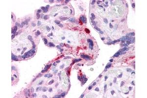 Immunohistochemistry (IHC) image for anti-Leucine Rich Repeat Containing 8 Family, Member B (LRRC8B) (Middle Region) antibody (ABIN635111)