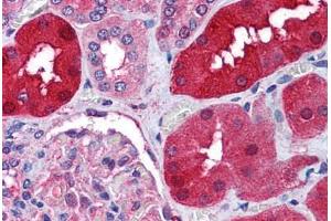Human Kidney (formalin-fixed, paraffin-embedded) stained with RNF213 antibody ABIN290404 at 1. (RNF213 Antikörper  (AA 5191-5204))
