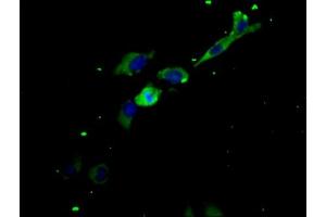 Immunofluorescence staining of Hela cells with ABIN7158226 at 1:200, counter-stained with DAPI. (LIFR Antikörper  (AA 915-1086))