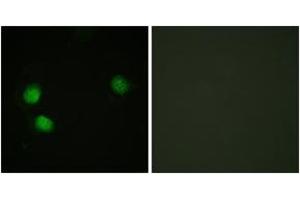Immunofluorescence analysis of HeLa cells, using Bloom Syndrome (Phospho-Thr99) Antibody. (Bloom Syndrome (AA 65-114), (pThr99) Antikörper)