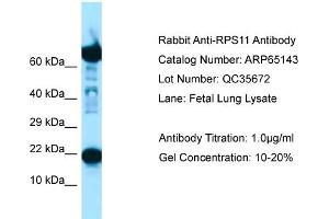 Western Blotting (WB) image for anti-Ribosomal Protein S11 (RPS11) (C-Term) antibody (ABIN2790056)