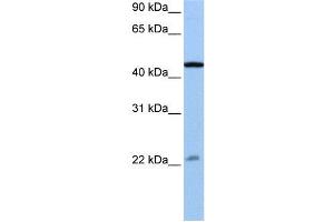WB Suggested Anti-EWSR1  Antibody Titration: 0.